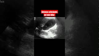LODO BILIAR SÍNTOMAS PRINCIPALES