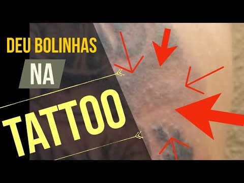 Vídeo: Erupção De Tatuagem: Espinha, Sintoma De Alergia Ou Infecção? Plus Treatmen