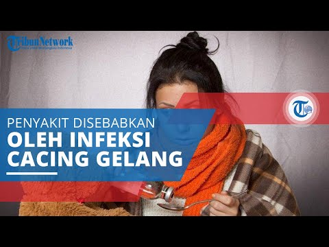 Video: Bagaimana Cacing Gelang Meninggalkan Tubuh Setelah Pengobatan