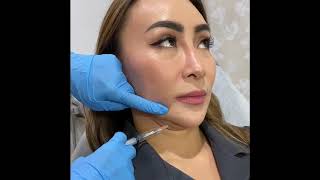 Double Chin Removal Resimi