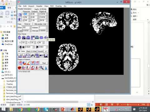 20170603 VBM Ep04 【Standard VBM process - Step by step】