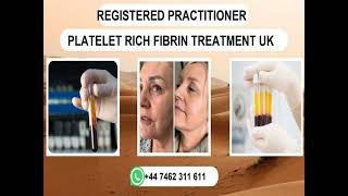 The Best,  44 7462 311 611 Beauty Clinics PRF Treatment UK Sheffield