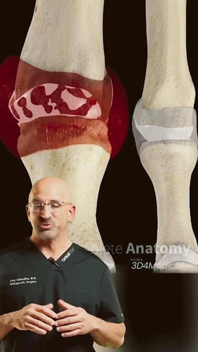 Your Big Toe’s Enemy #1 - Gout Can Take You Out #shorts
