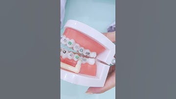 🦷Bàn chải kẽ - 