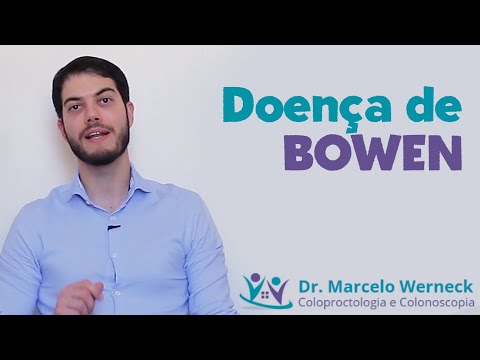 Vídeo: Doença De Bowen: Sintomas, Tratamento, Fotos