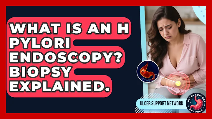 What Is An H Pylori Endoscopy? Biopsy Explained. - Ulcer Support Network