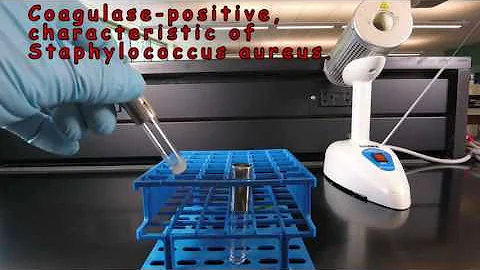 Coagulase Test for Staphylococcus