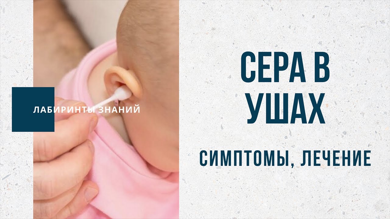 Серная пробка в ухе. Симптомы, Лечение - Лабиринты Знаний - YouTube