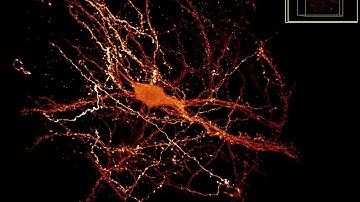 Expansion Microscopy - Thy1 GFP transgenic mouse