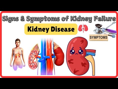 Symptoms and Signs