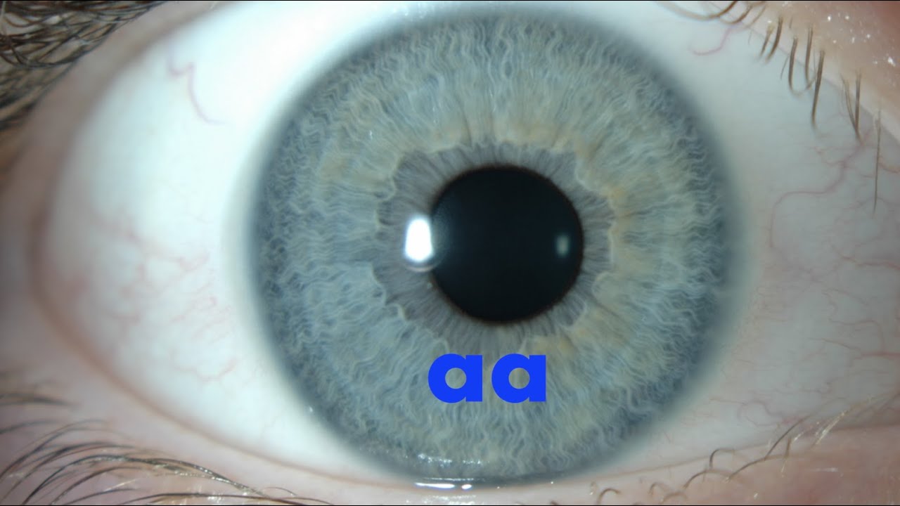 Color de ojos fenotipo, genotipo, razas puras e híbridas YouTube