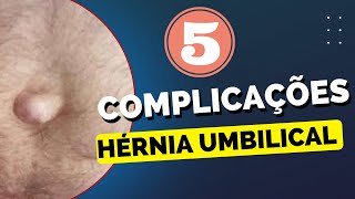 5 COMPLICAÇÕES DA CIRURGIA DE HÉRNIA UMBILICAL!!