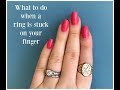 Amazing trick to remove a stuck ring from your finger  diy