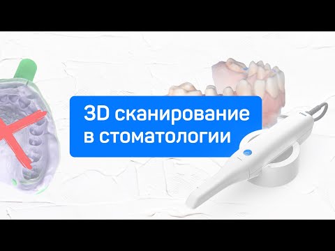 Современные технологии в стоматологии. 3D сканер.