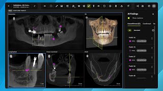 DS Core - Diagnose Features: Smart View – Detect