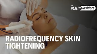Benefits of Radiofrequency Skin Tightening