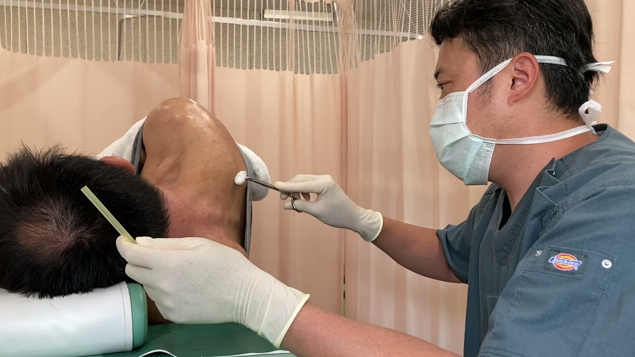 子宮頸部硬膜外ステロイド注射の成功率