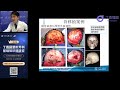 软骨 骨 神经 肌肉移植 | Cartilage, Bone, Nerve, and Muscle Grafting