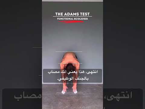 تمارين علاج الكتف المائل