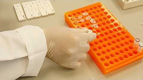 DDTD Universal IgG Lateral Flow Assay