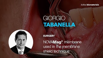 The magnesium membrane shield technique using the NOVAMag® membrane by Dr. Giorgio Tabanella