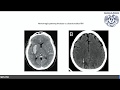 COVID-19 y Neurociencias