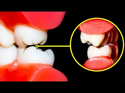 How to Stop Grinding Your Teeth at Night