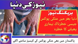 Pakistan me monkey pox cases reported|| monkey pox Pakistan me phelny ka khatra #viral #news alerts