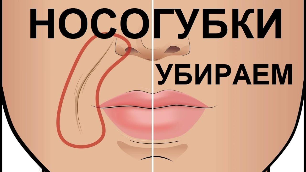 Уменьшаем Носогубки. Убираем Носогубные складки.#носогубки# ...