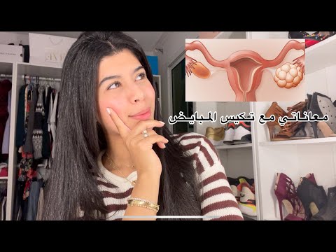 فيديو: لماذا المبيض الكونغولي؟