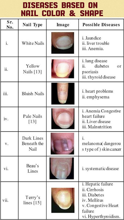 Diseases Based on nail color & Shape #shorts #youtubeshorts #nails