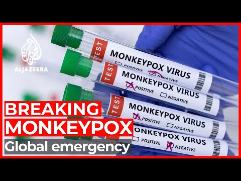World Health Organization declares monkeypox a global emergency