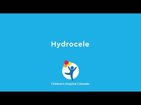 Video: Hydrocele: Uzroci, Vrste I Načini Liječenja