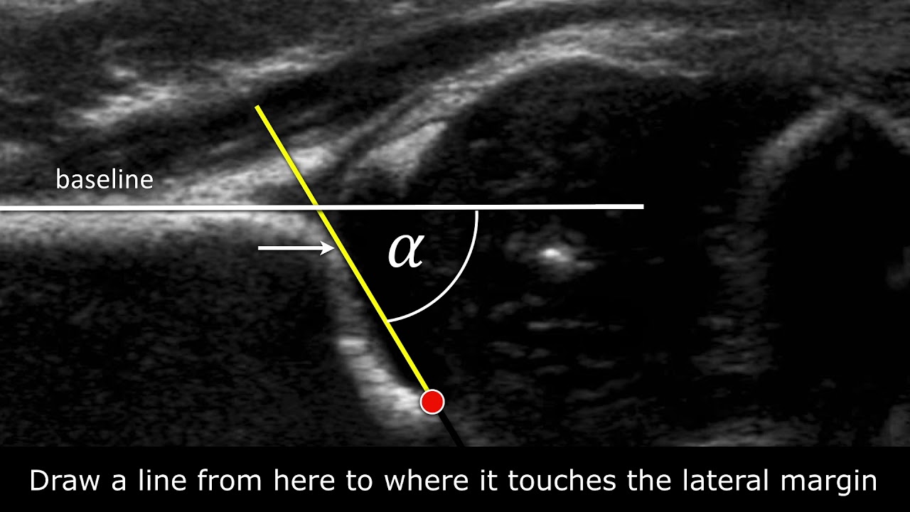angles measure congenital