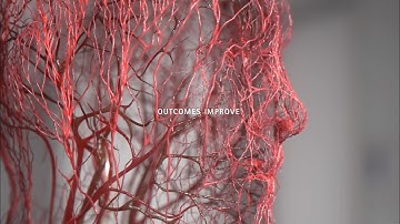 Introducing the Peripheral Advantage® Program