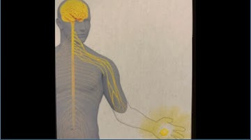 Phantom Limbs and Mirror Therapy
