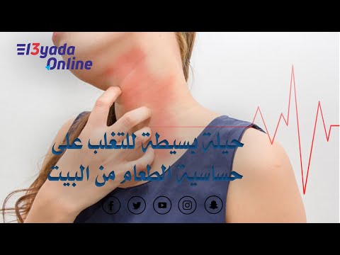 فيديو: لماذا نتلقى الحساسية؟