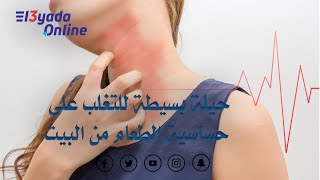 العيادة أونلاين - ماهي الأكلات التي تسبب حساسية الجلد مع دكتور ندى رضا