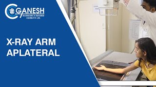 X-Ray Arm Aplateral Ganesh Diagnostic Imaging Center