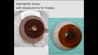 Educational video on types of prosthetic lenses screenshot 2
