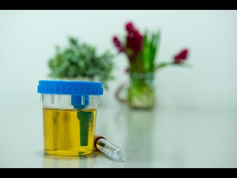 Video: Biochemische Analyse Van Urine: Hoe Te Verzamelen, Wat Toont De Normen