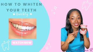How to get white teeth fast! #teethwhitening #teeth #whiteteeth