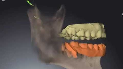 Bio-functional dynamic occlusion