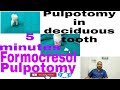 Formocresol pulpotomy on deciduous tooth/ 5minutes formocresol pulpotomy/ preclinical exercise