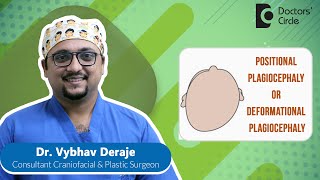 Flat Head Syndrome| Plagiocephaly & Its Treatment #newborn  - Dr. Vybhav Deraje | Doctors' Circle