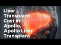 Liver Transplant Cost In Apollo Hospital, Apollo Liver Transplant