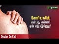 What is Psoriasis and How To Get Rid of Psoriasis | Doctor On Call | 09/08/2019