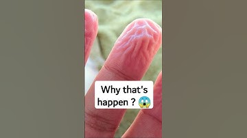 Why Do Fingers Wrinkle in Water? The Science Behind the Mystery!
