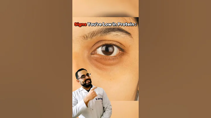 Signs You're Low In Protein : #shorts #signs #brightskin