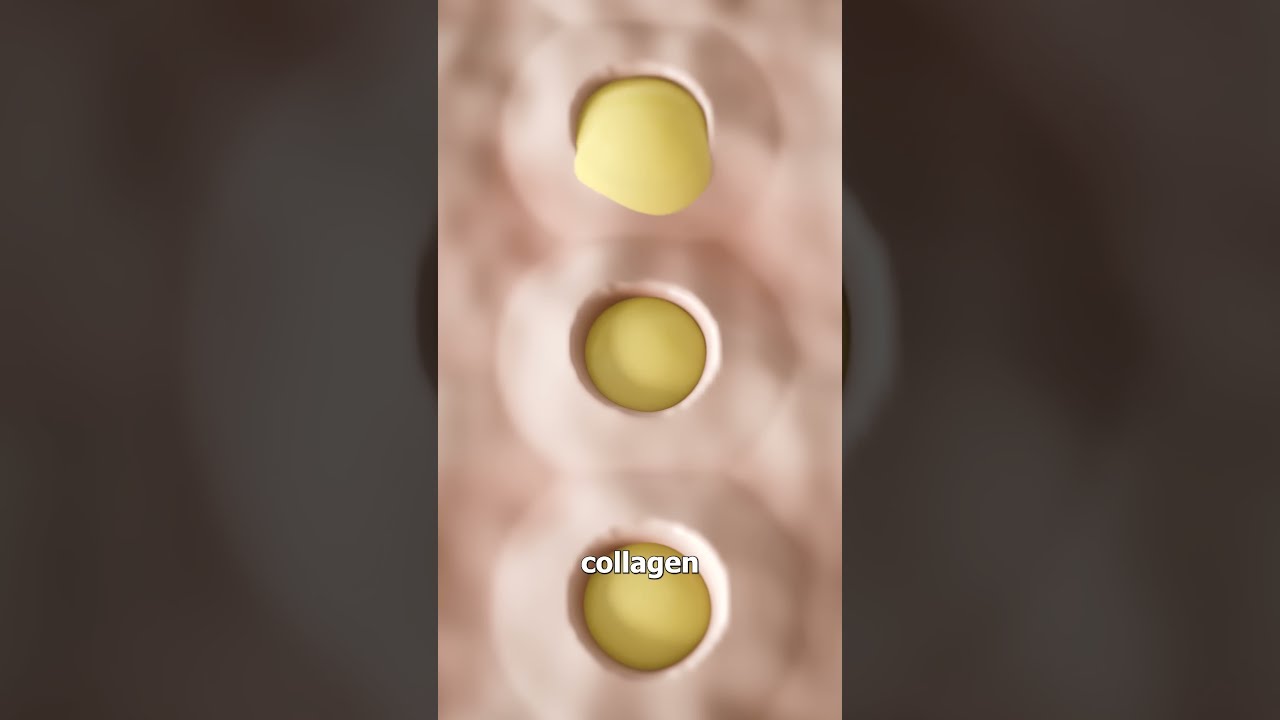 How A Derma Roller Works 